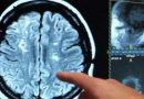 Día del Cerebro  – Descubren lo que  diferencia a las personas optimistas de las pesimistas