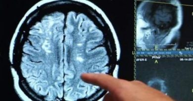 Día del Cerebro  – Descubren lo que  diferencia a las personas optimistas de las pesimistas