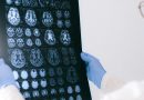 OMS – Sorpresivo hallazgo contra el Alzheimer por el efecto de dos vacunas que hoy se usan para otras enfermedades